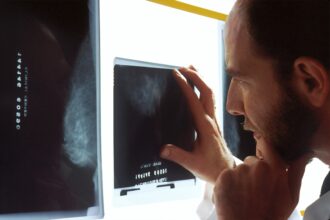 Γιατρός σε δημόσιο νοσοκομείο της Γερμανίας εξετάζει προσεκτικά ακτινογραφία θώρακος σε φωτεινό πίνακα, φορώντας ιατρική ρόμπα, με θολό φόντο ιατρικού εξοπλισμού